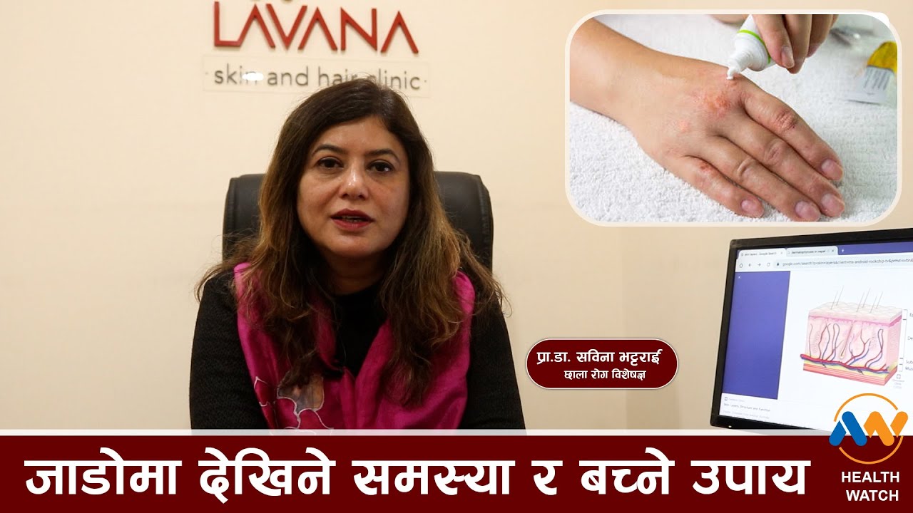 जाडोमा छालामा देखिने समस्याबाट बच्न के गर्ने ? (भिडियो रिपाेर्ट)